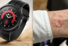 Владельцы Samsung Galaxy Watch жалуются на перегрев и раздражение кожи во время сна