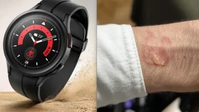 Владельцы Samsung Galaxy Watch жалуются на перегрев и раздражение кожи во время сна